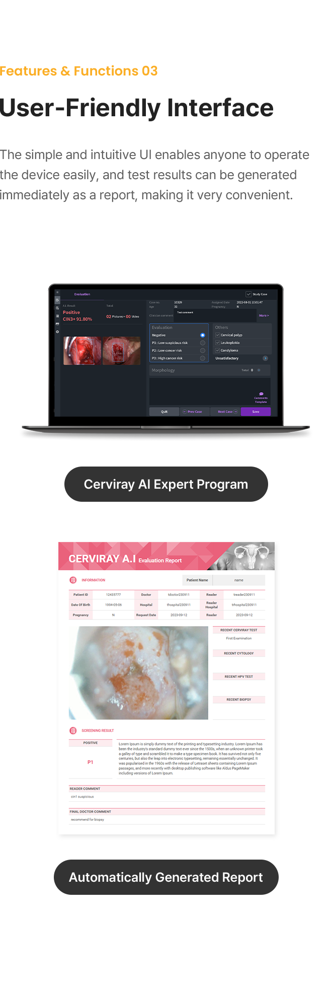 Cerviray AI
